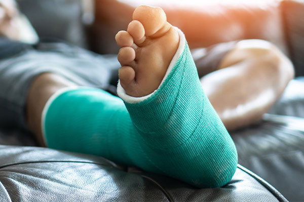 An image of a person s foot in a green cast, with the ankle wrapped in white bandages and supported by a splint, resting on a couch.